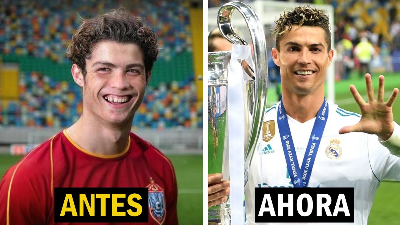 cristiano ronaldo antes y despues cirugía