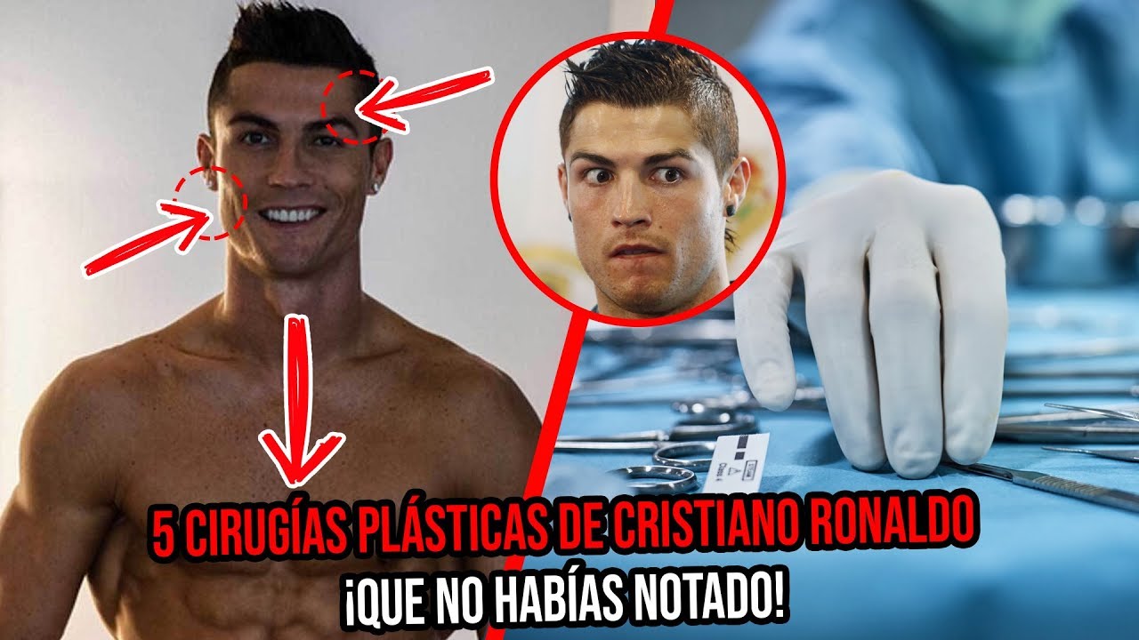 cristiano ronaldo antes y despues sonrisa