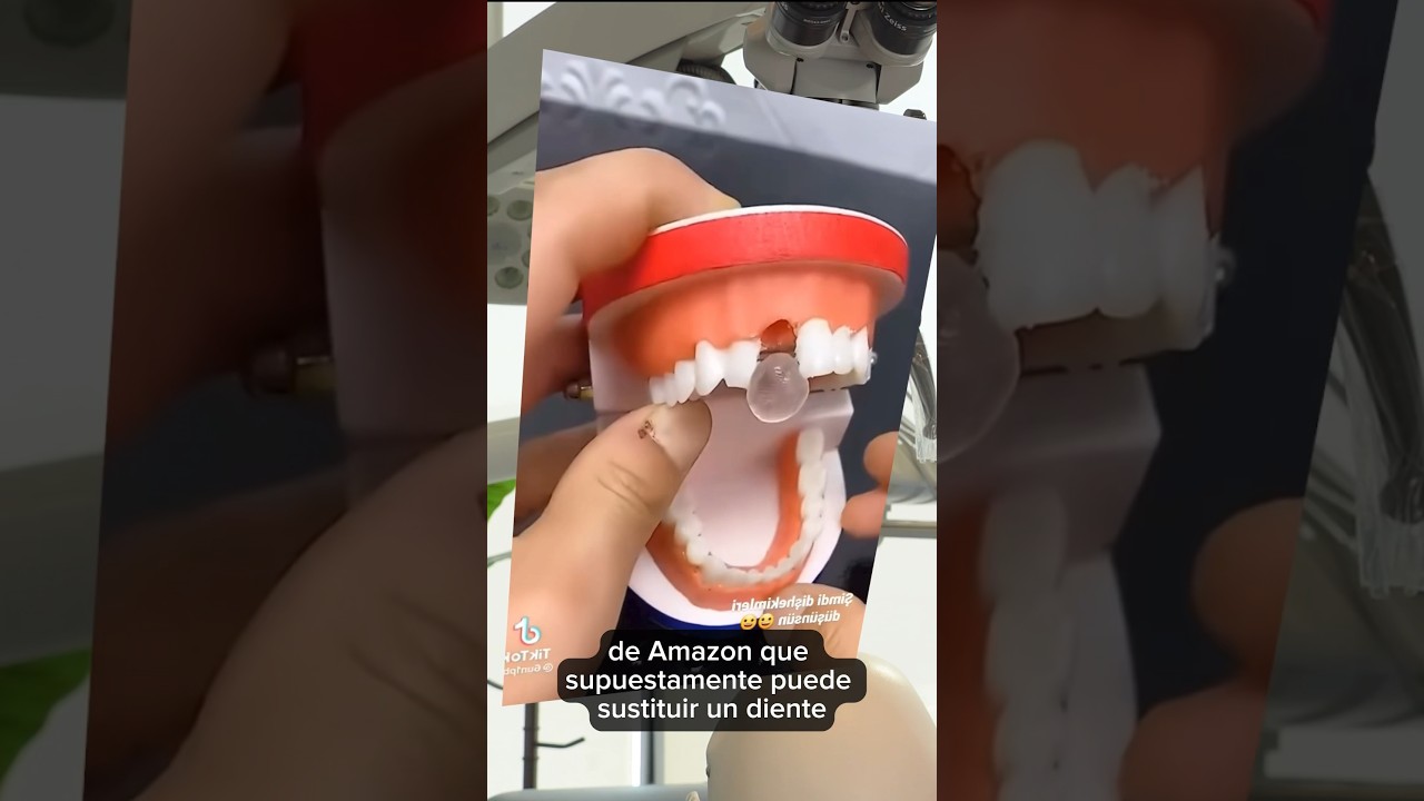 cuanto cuesta pegar una funda dental
