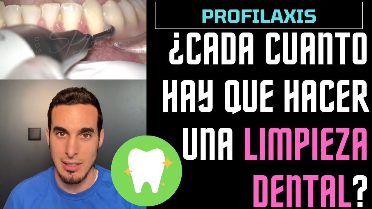 cuanto se tarda en hacer una limpieza bucal