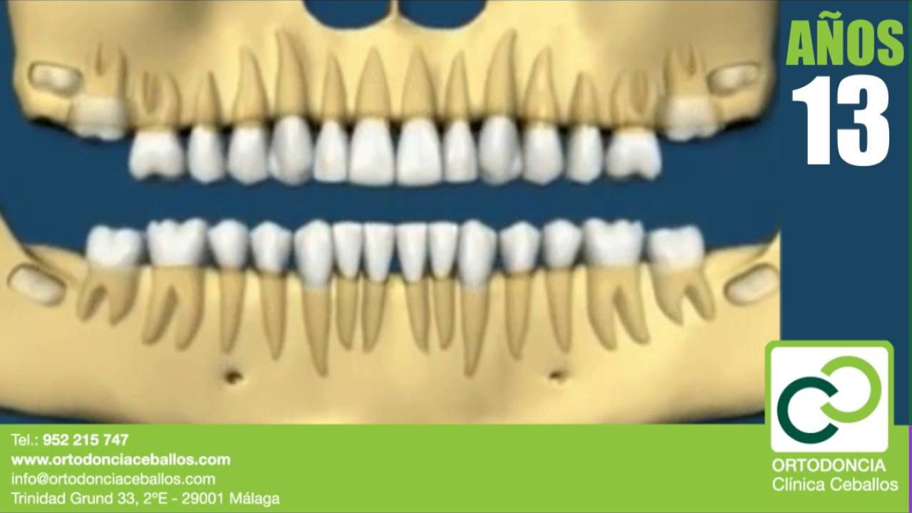 diferencia dientes de leche y definitivos