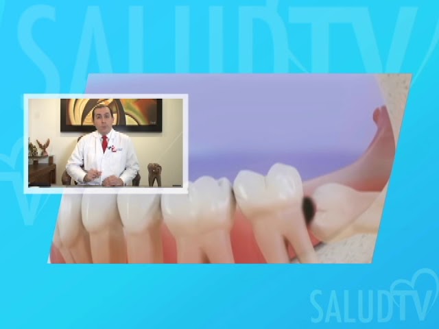 dolor de cabeza dientes y ojos