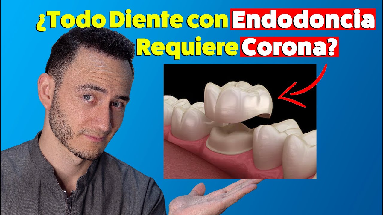 endodoncia y reconstrucción el mismo día