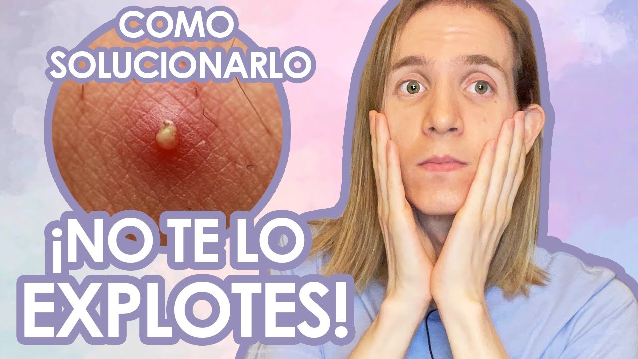 granos duros que no se quitan
