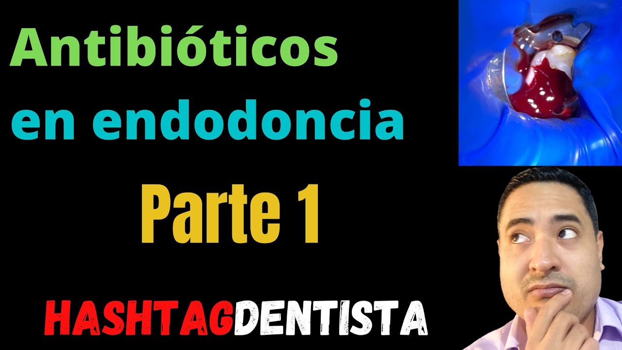 hay que tomar antibiótico después de una endodoncia