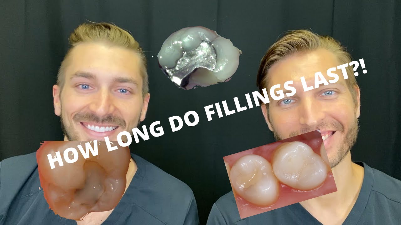 how long does tooth fillings last