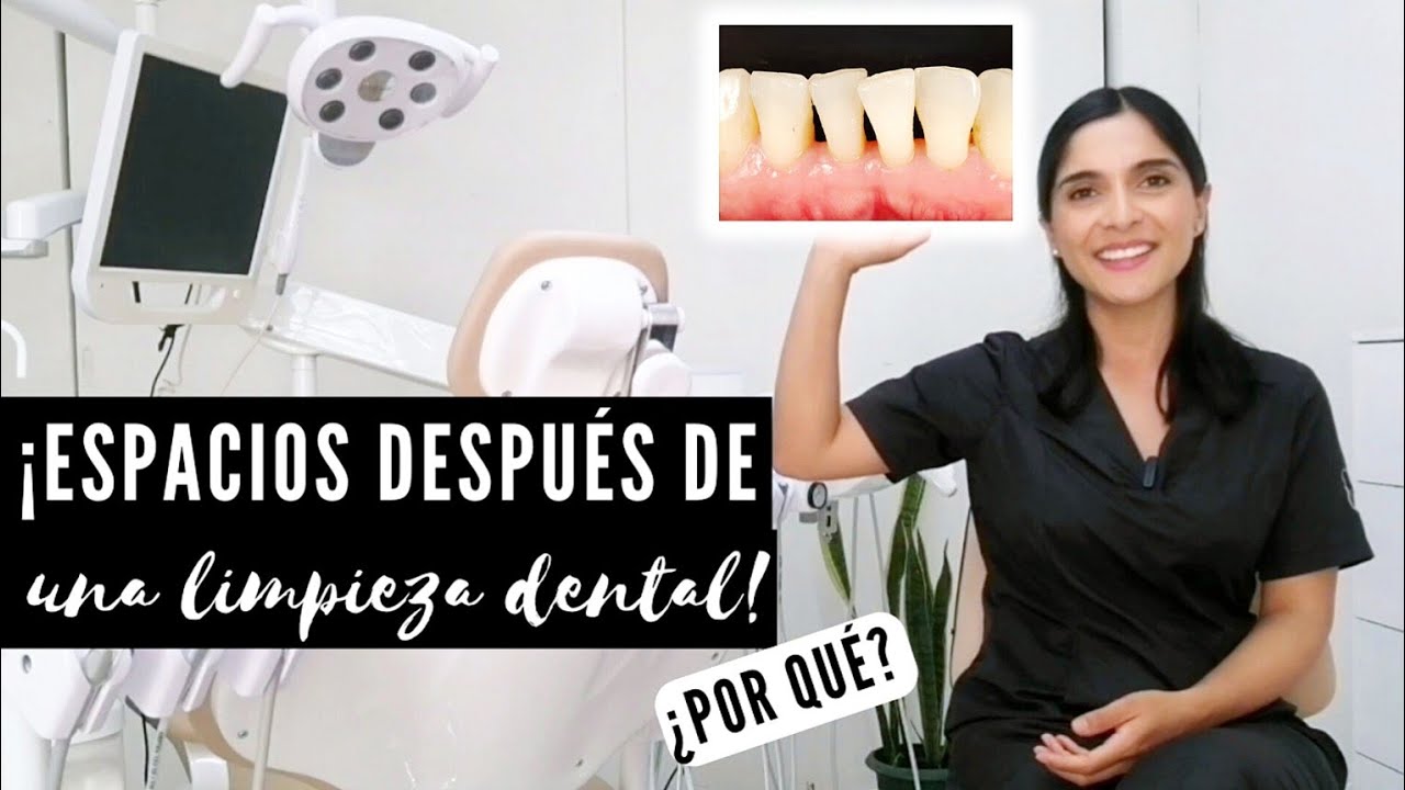 huecos entre los dientes despues de una limpieza