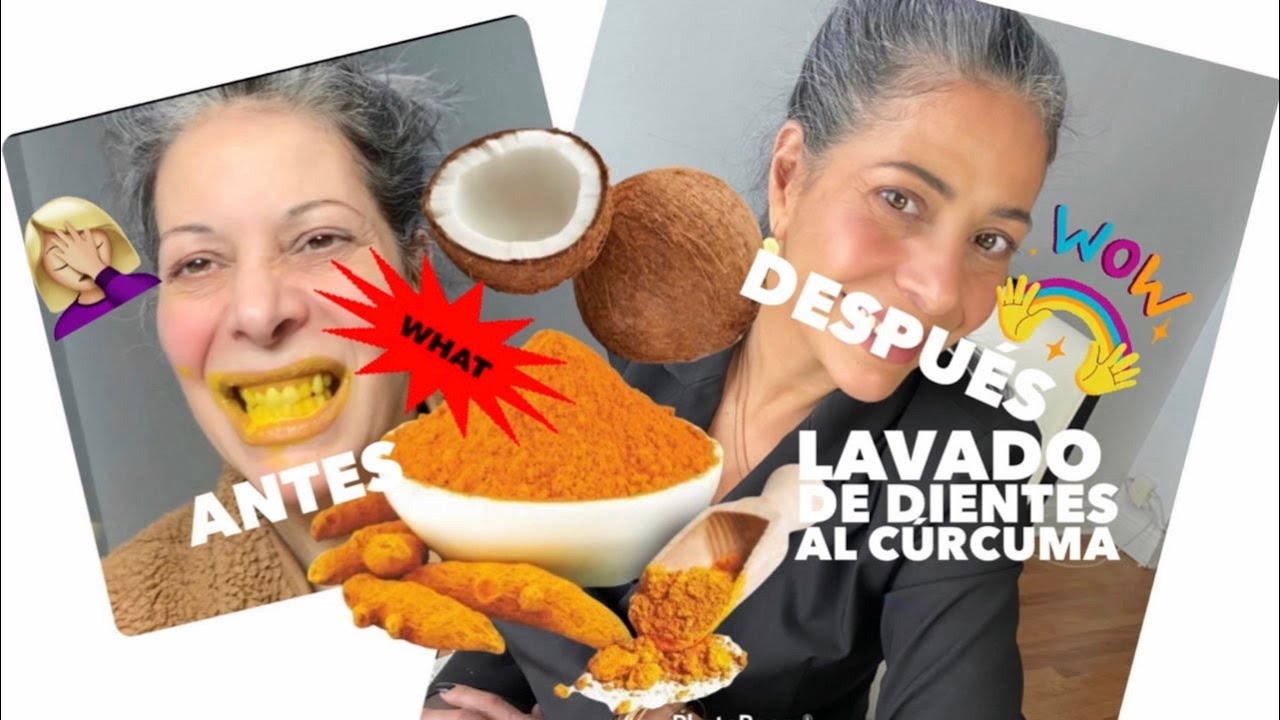 la cúrcuma daña el esmalte de los dientes