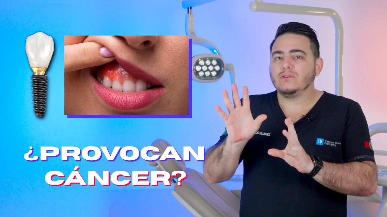los implantes dentales pueden provocar cáncer