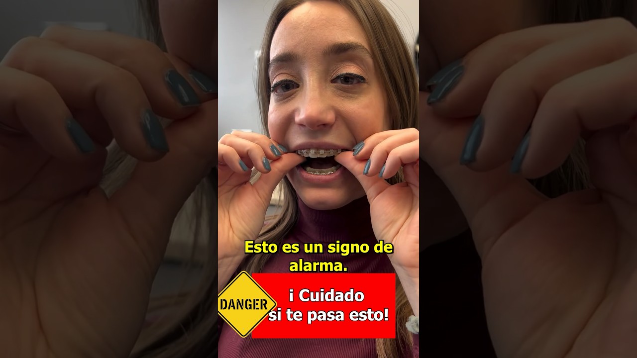 me quitaron los brackets y siento los dientes flojos