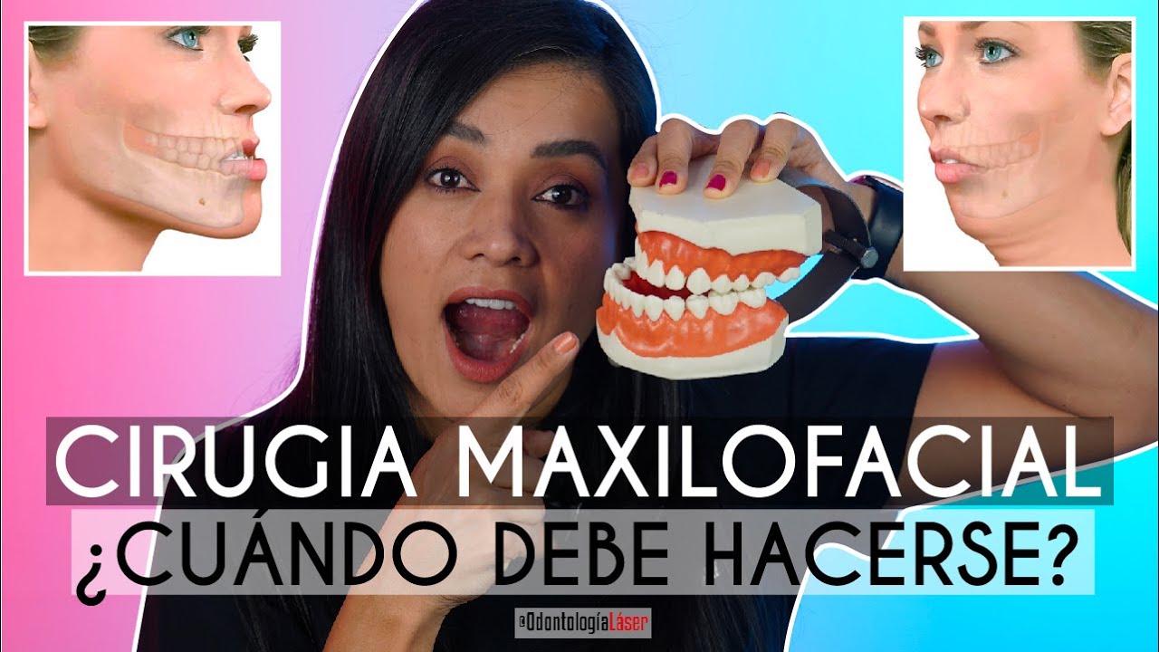 operación de mandíbula antes y después
