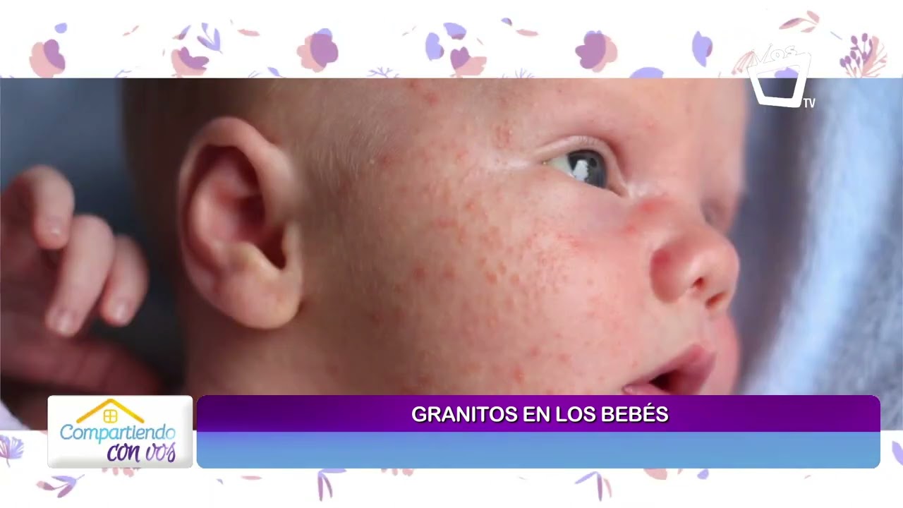 porque salen granitos a los bebes