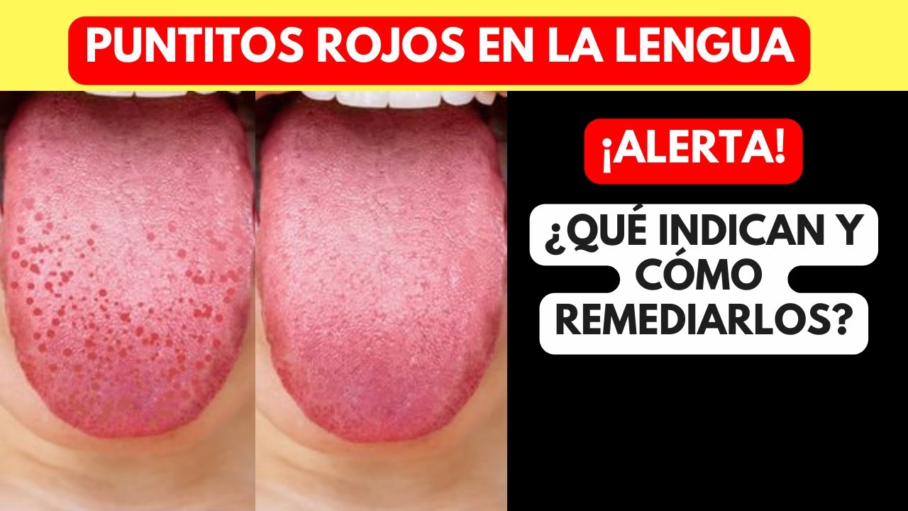 porque salen puntos en la lengua