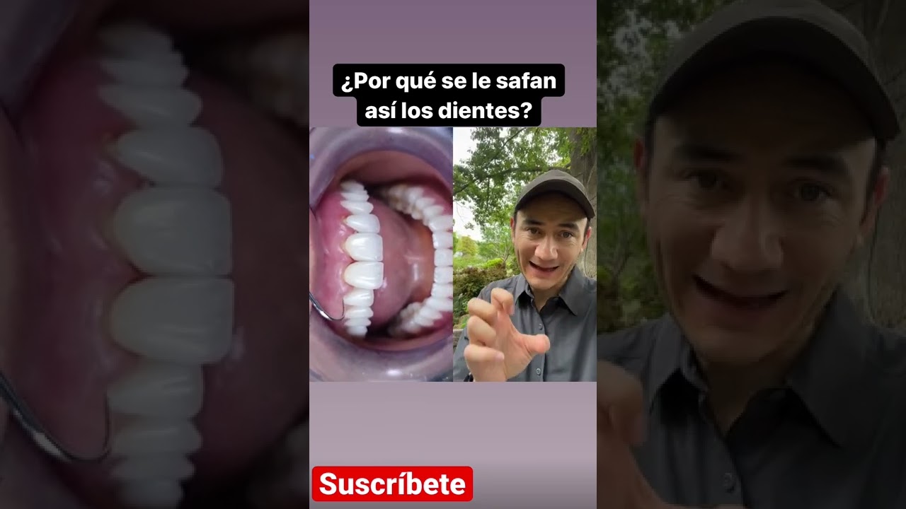 porque se les caen los dientes a los drogadictos