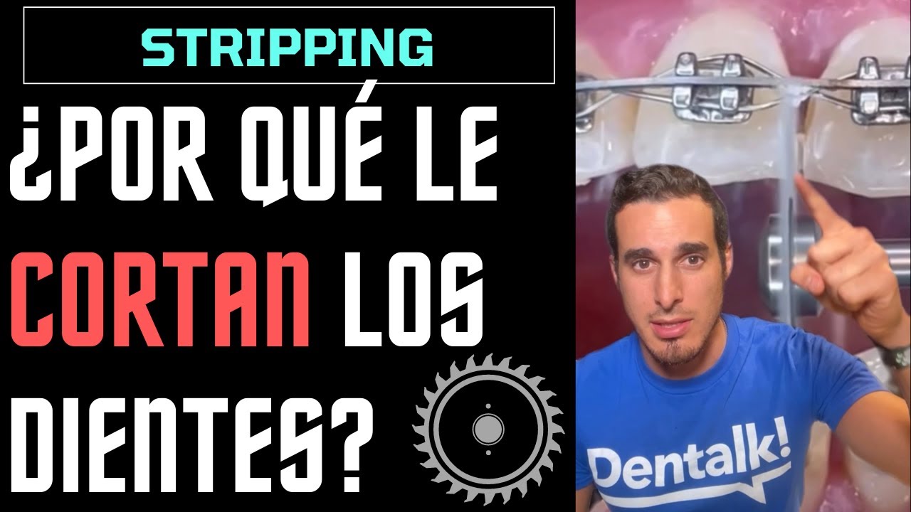 que es el stripping en ortodoncia