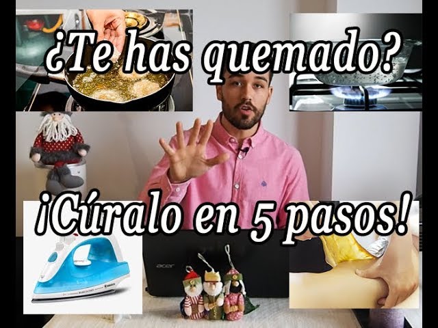 que hacer si te has quemado
