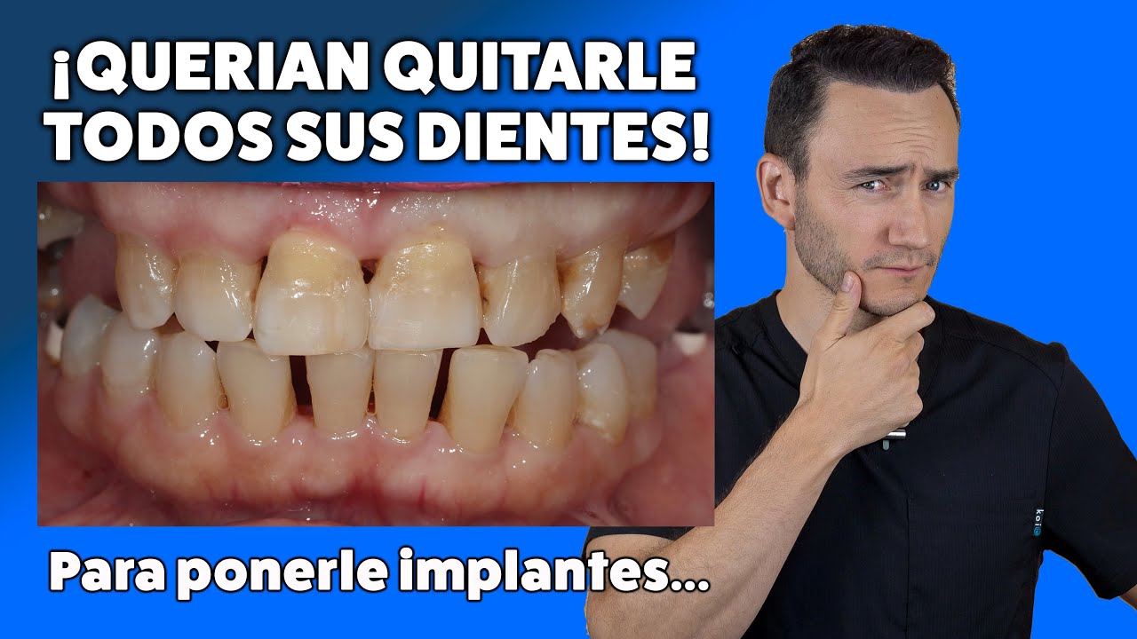 quitar todos los dientes y poner implantes