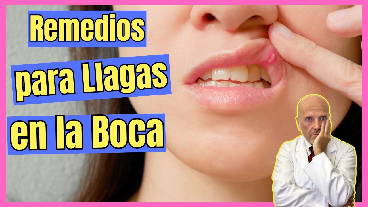 remedio casero para curar una llaga en el paladar