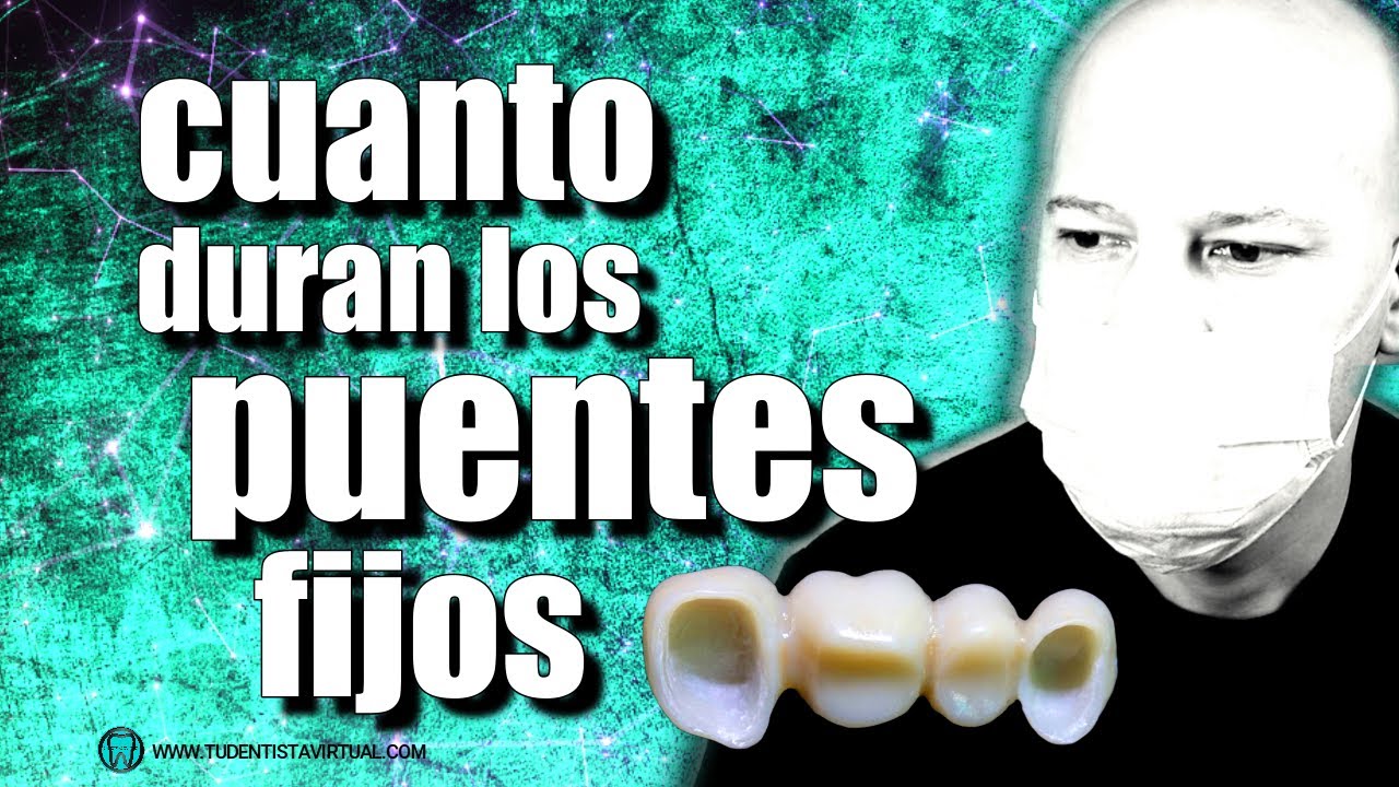 se puede arreglar un puente dental fijo
