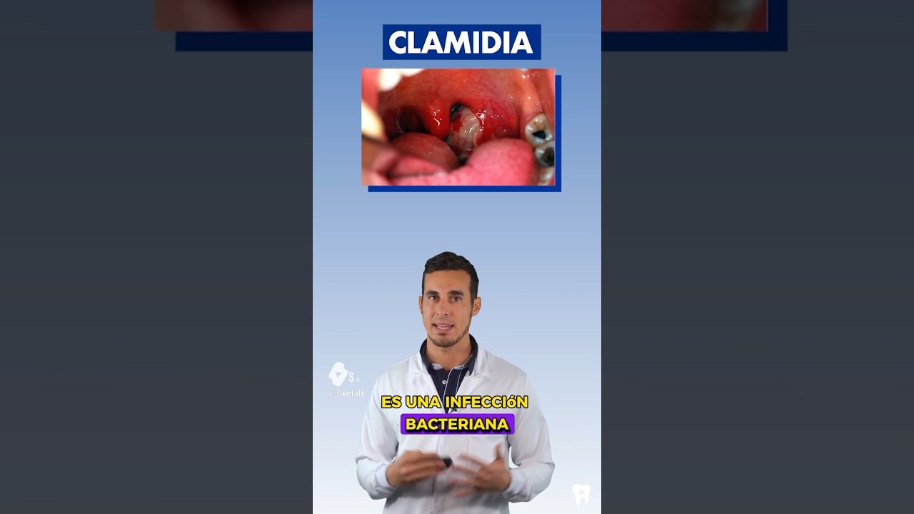 sintomas de infeccion en la boca