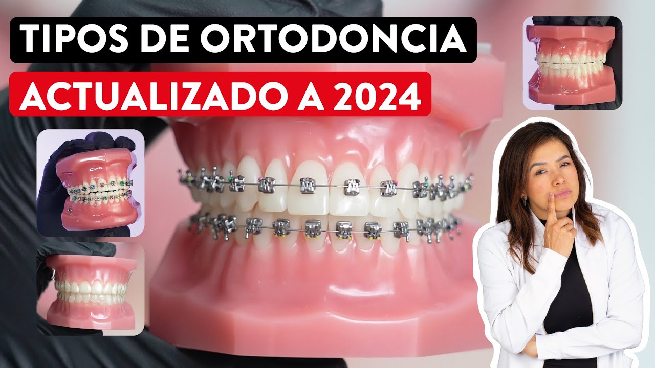 tipos de aparatos dentales y precios
