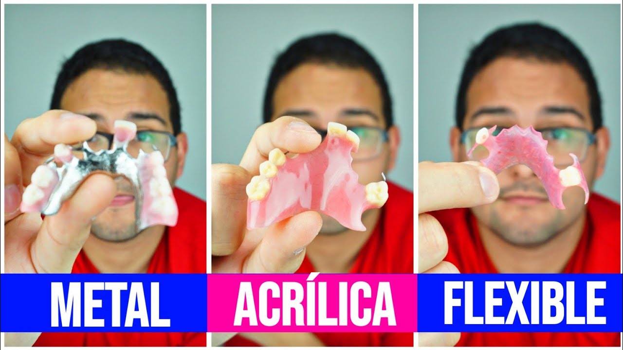 tipos de prótesis dentales y precios