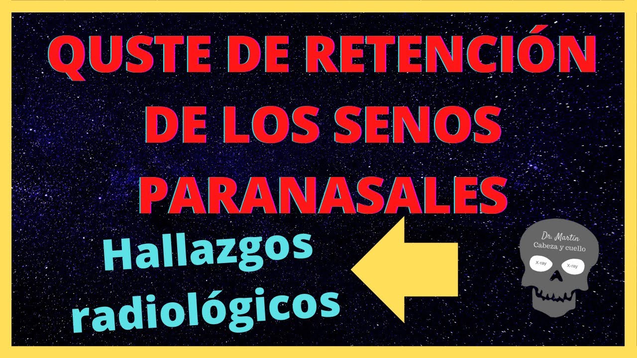 tratamiento quiste de retención en seno maxilar