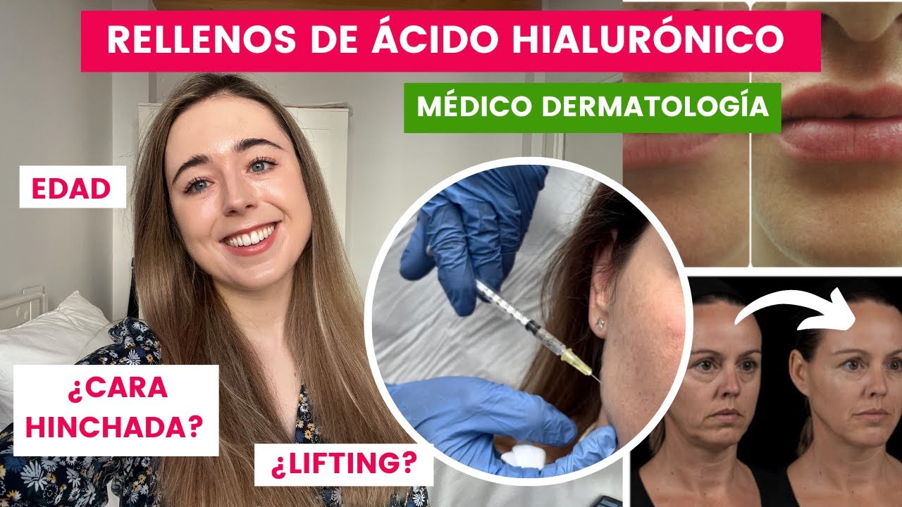 acido hialuronico cara antes y despues