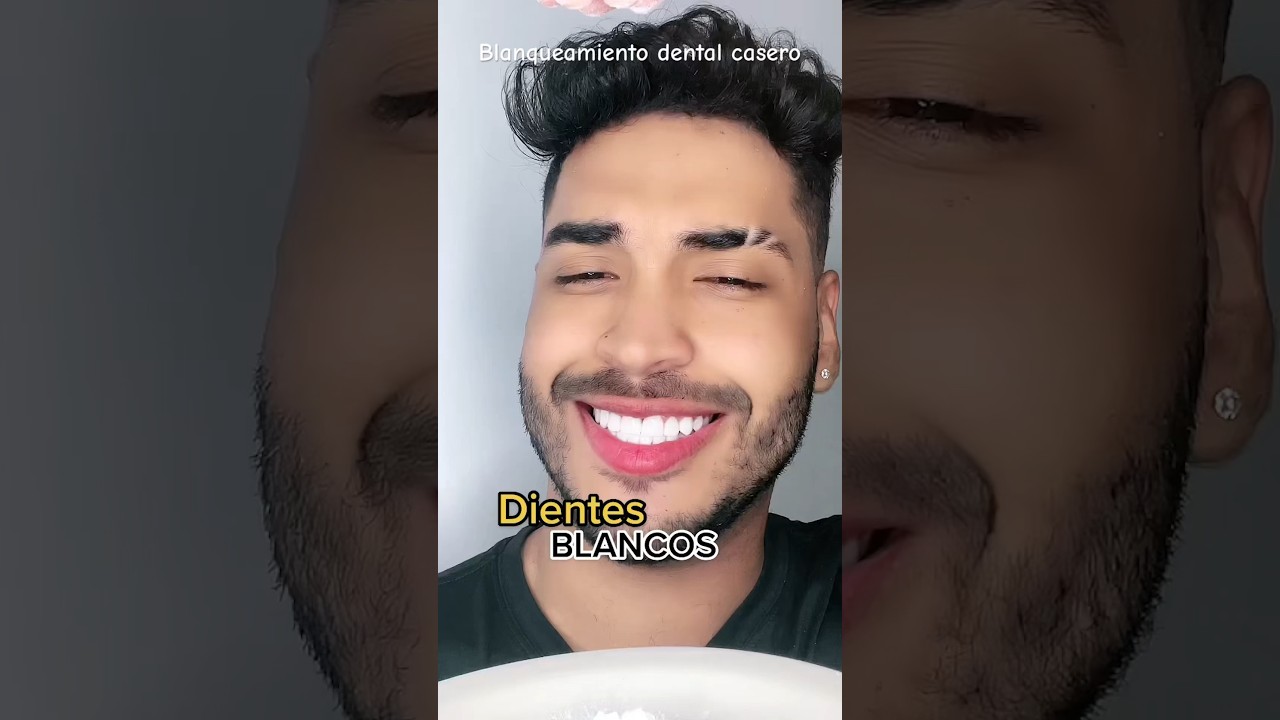blanquear dientes en casa sin dañarlos