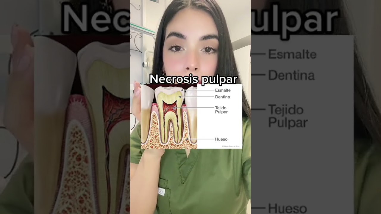 bolita blanca en la encia de abajo