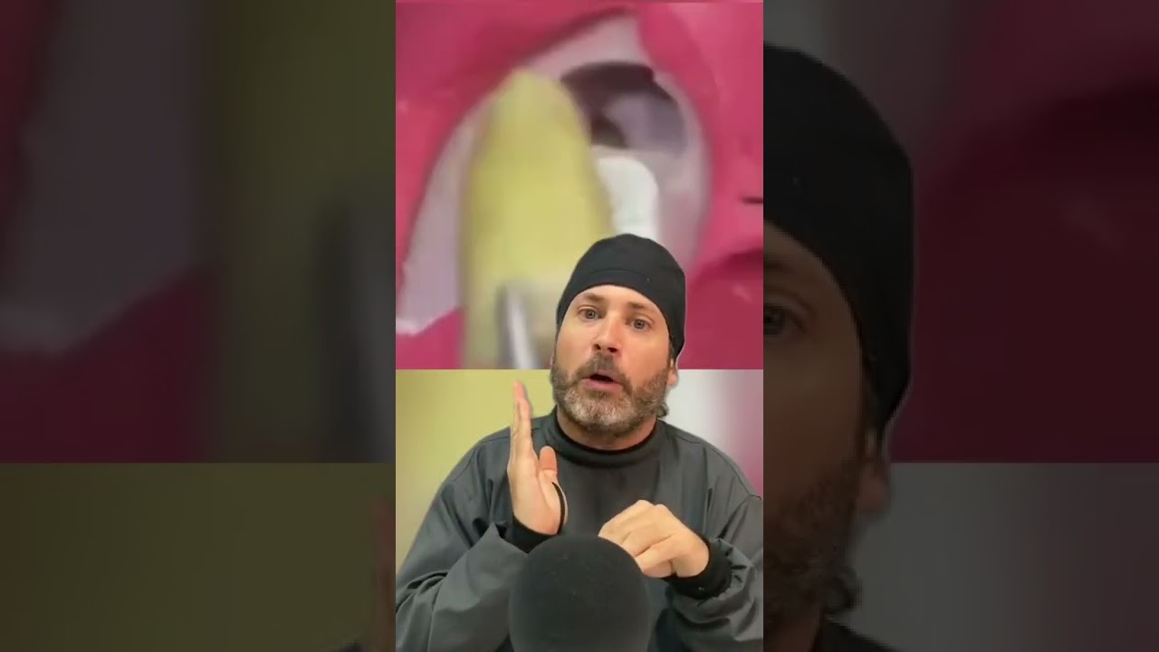 cirugia de la muela del juicio