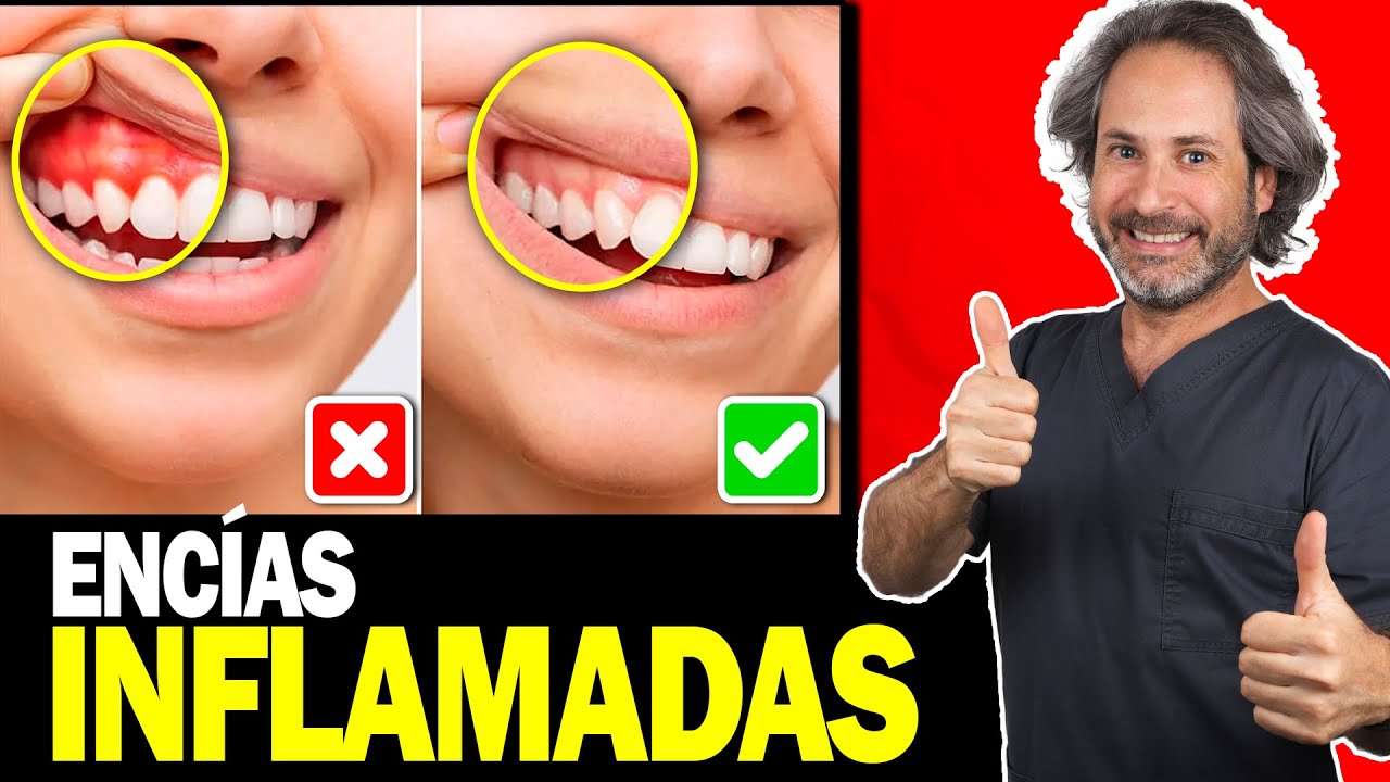 como calmar el dolor de encia inflamada