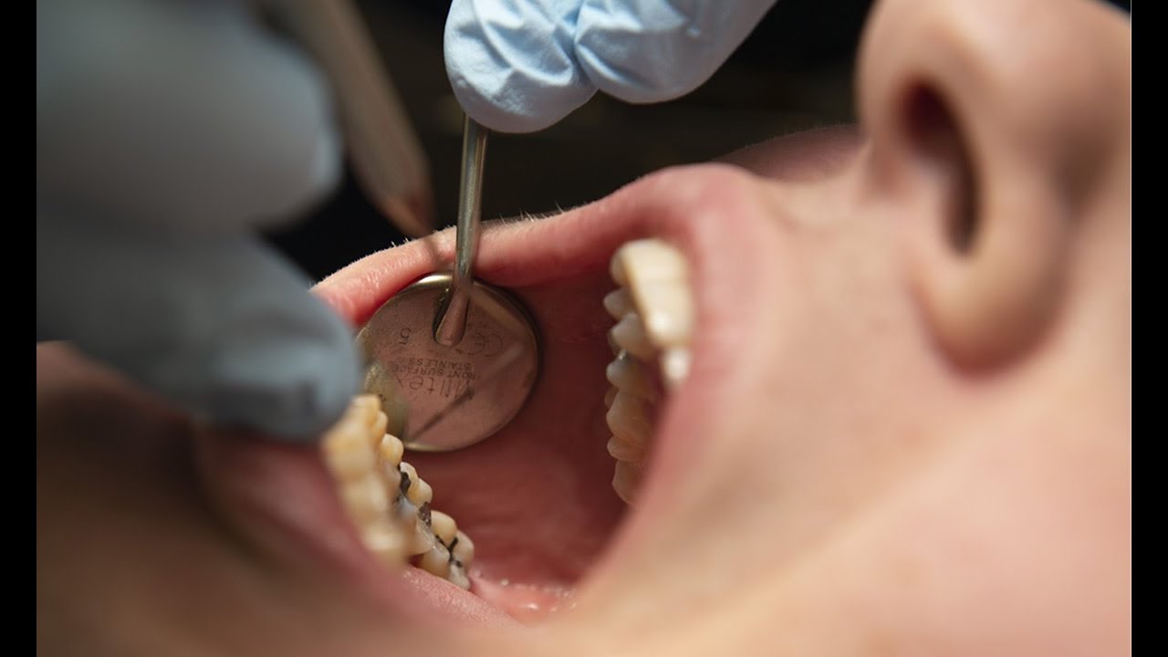 como quitar dolor de muela por sinusitis