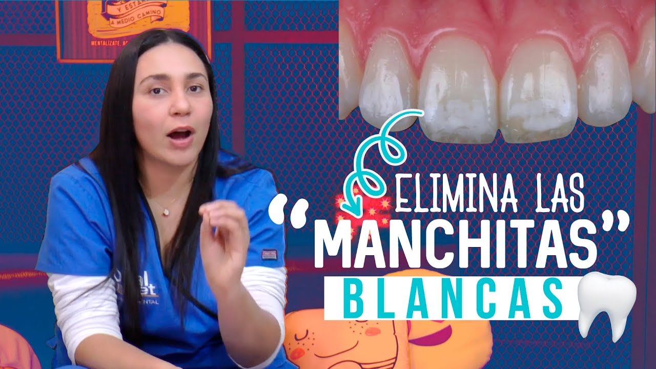 como quitar manchas blancas de los dientes