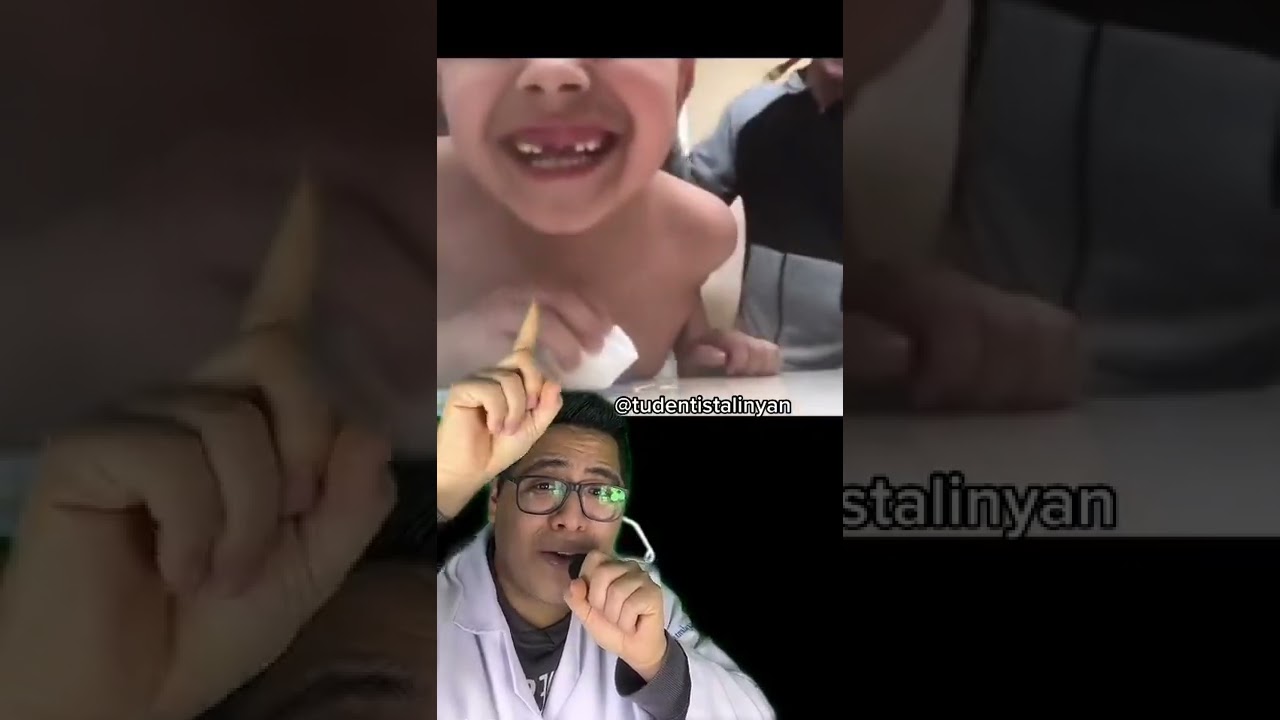 como quitar un diente de leche sin dolor
