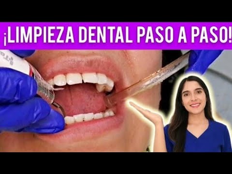 como se llama el aparato para hacer limpieza dental