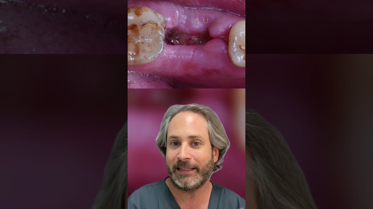 como se ve una cirugia de muela infectada