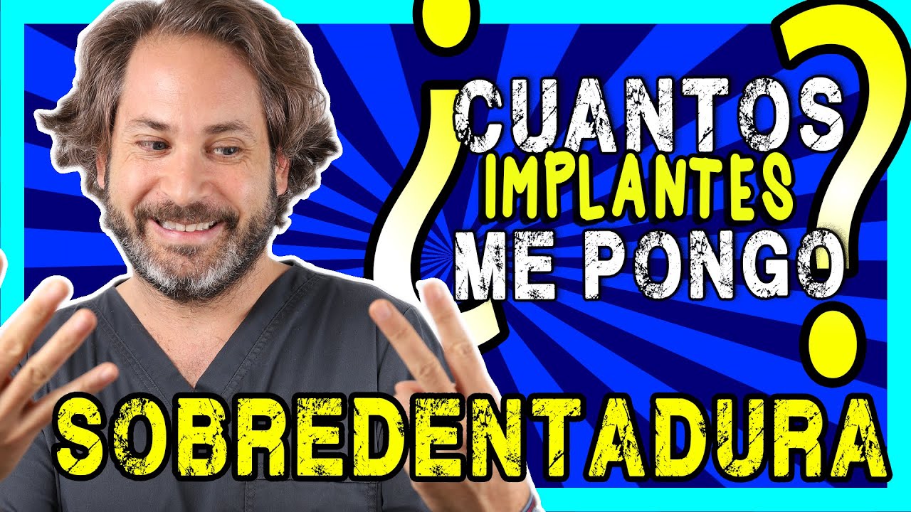 cuantos implantes son necesarios para una dentadura fija