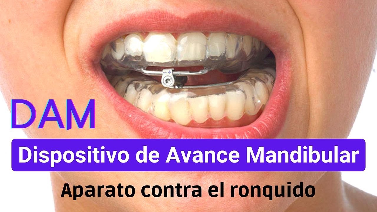 dam dispositivo de avance mandibular precio