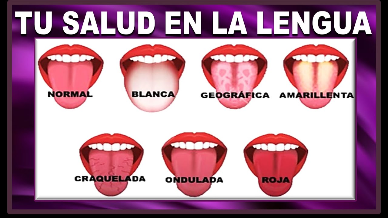 enfermedades de la lengua y boca