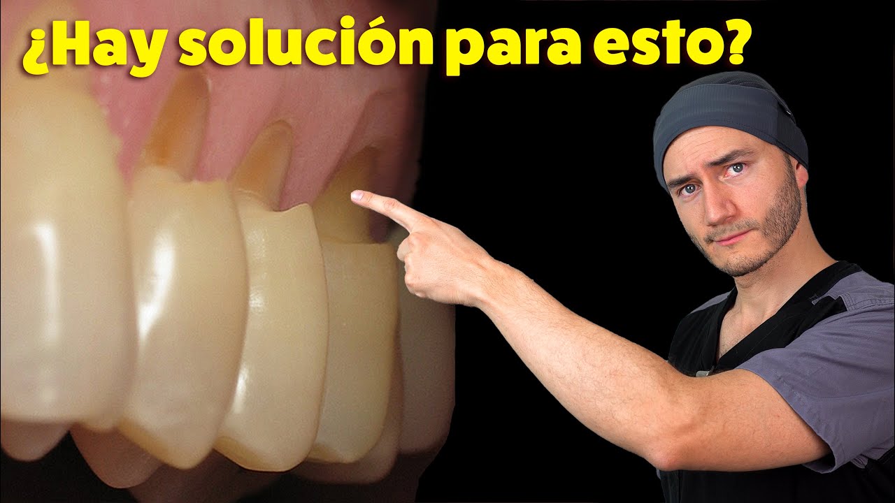 enfermedades que causan manchas en los dientes