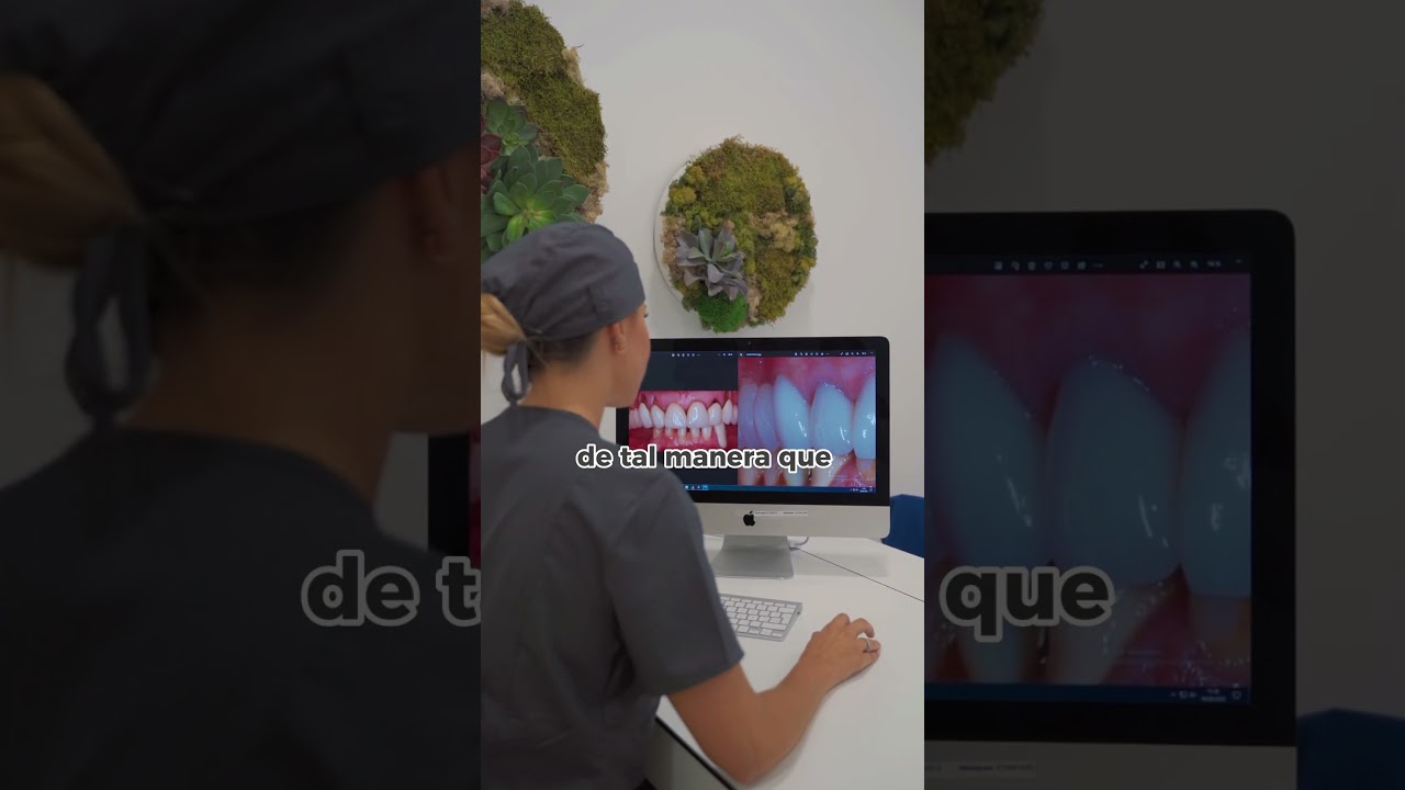 evolucion de un injerto de encia