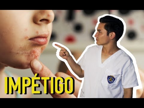 granitos alrededor de la boca niños
