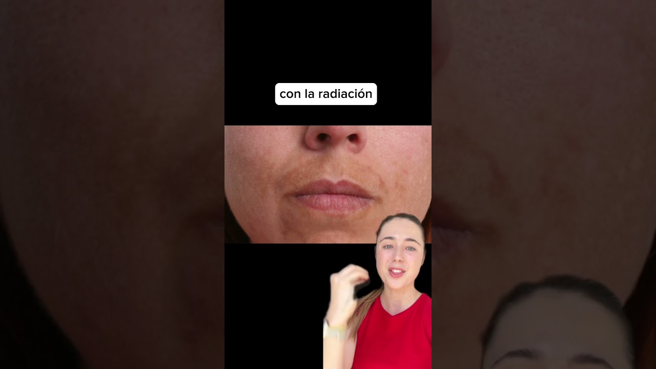 mancha roja en el labio inferior