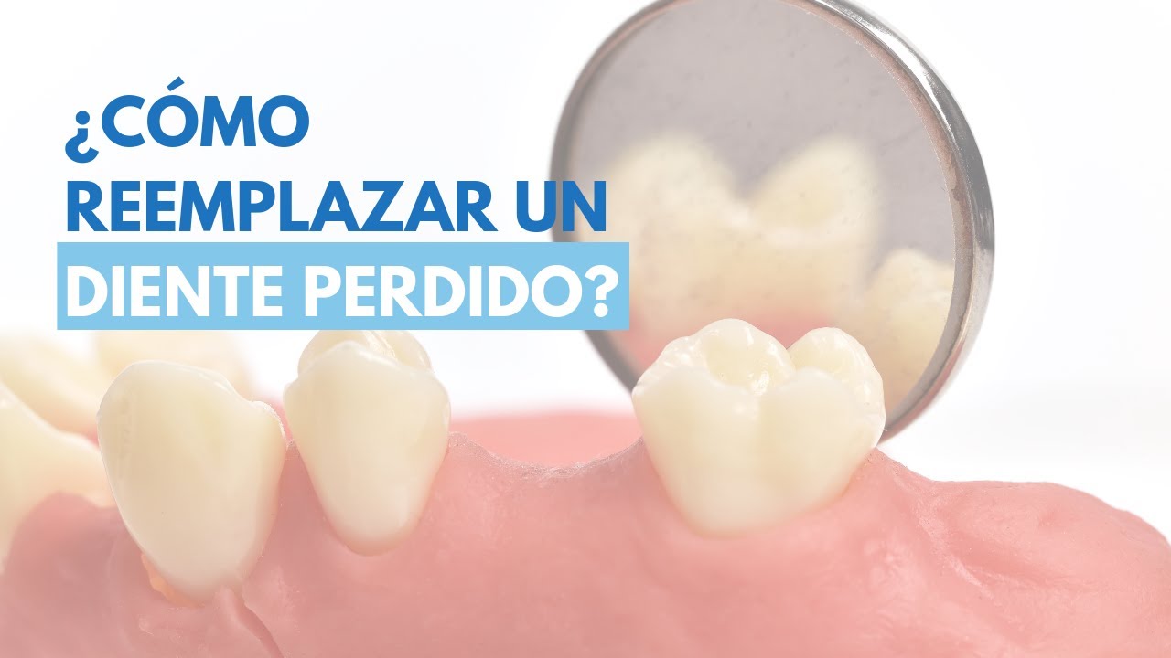 me falta un diente como lo disimulo