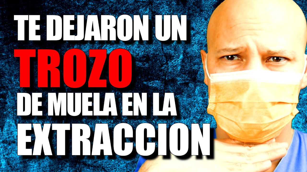 me han dejado un trozo de muela dentro
