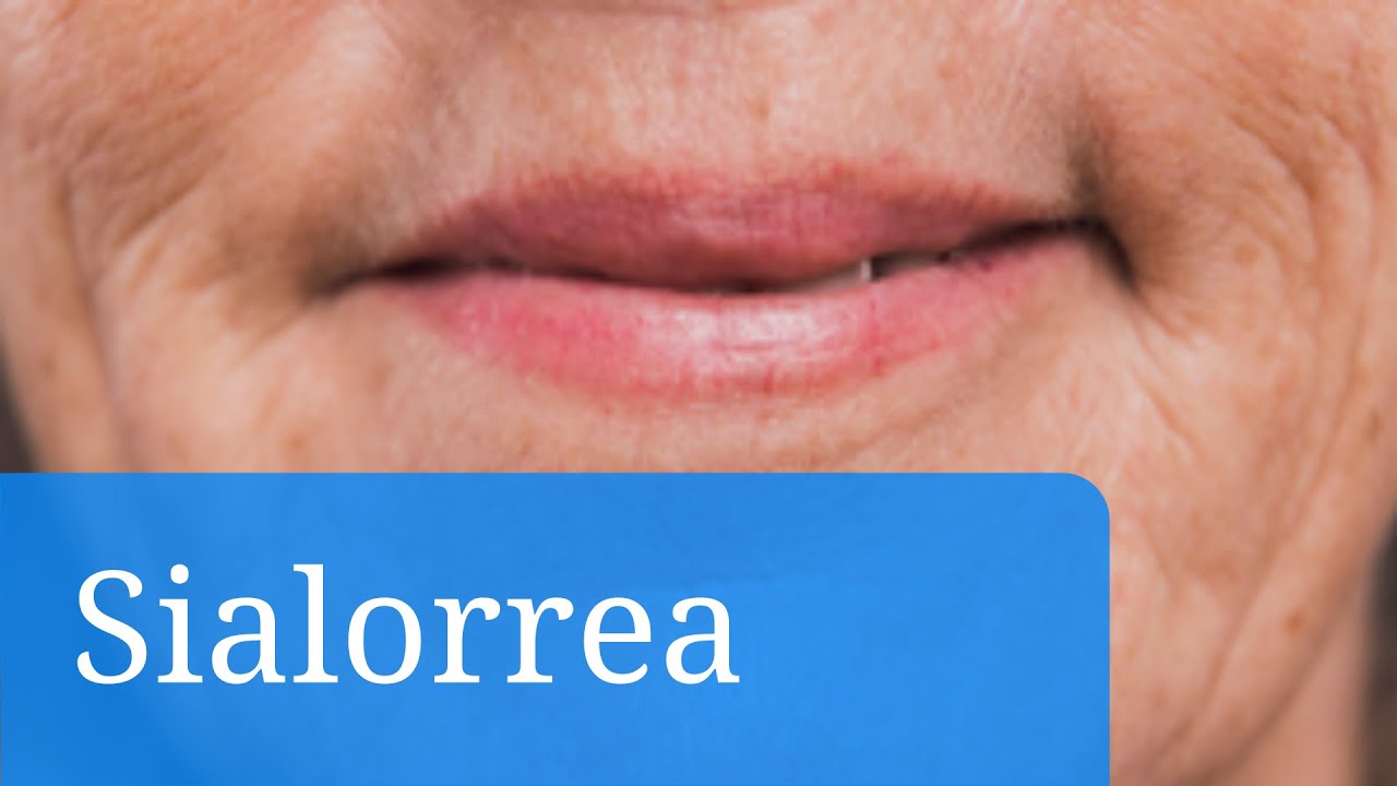 medicamentos para el exceso de saliva