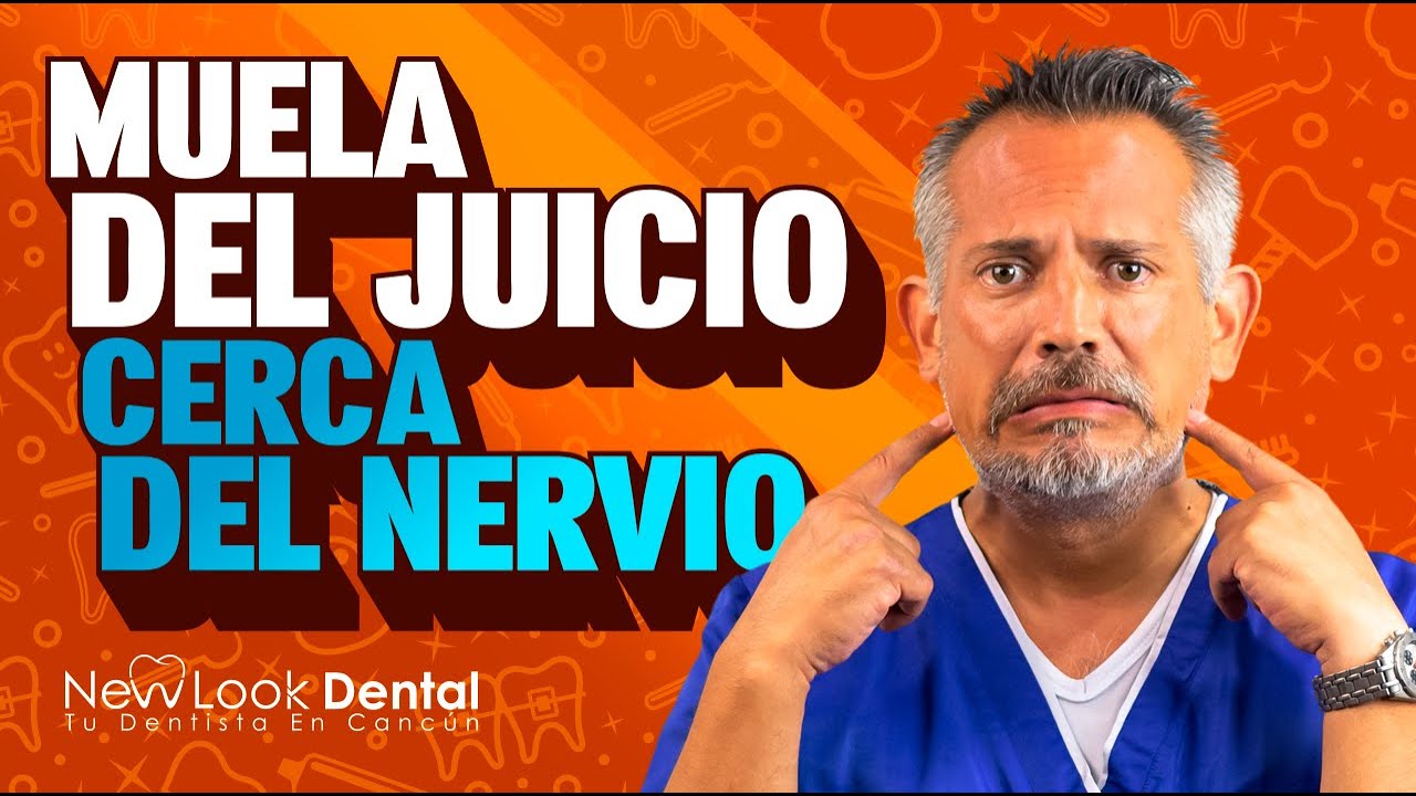 muela del juicio cerca del nervio