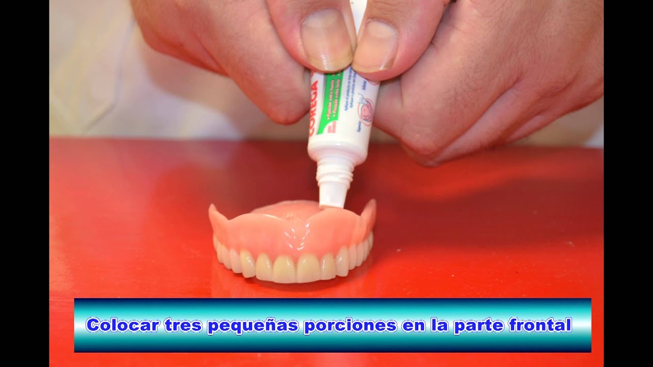 pegamento para dientes que se mueven