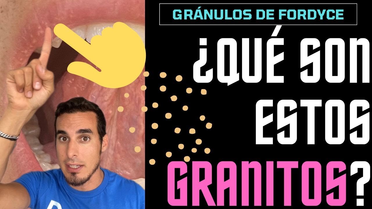 picor en los labios de la boca